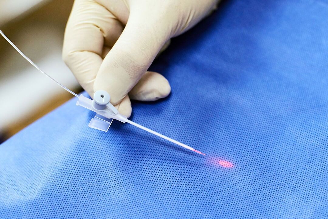 dispositivo transrectal para el tratamiento de la próstata